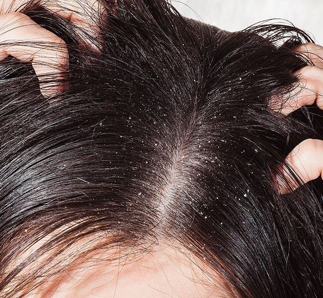 263a56dd658999a7bfb07bd84dff4a00